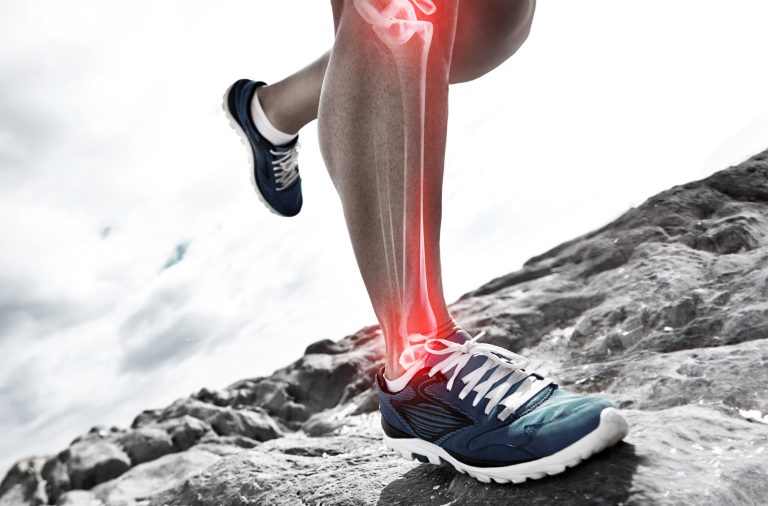 Benefits of Physiotherapy in Ankle Injuries